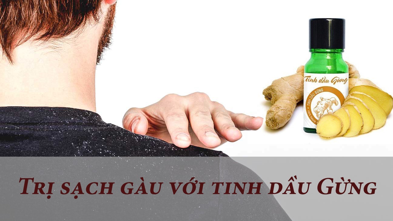 Trị sạch gàu bằng tinh dầu gừng