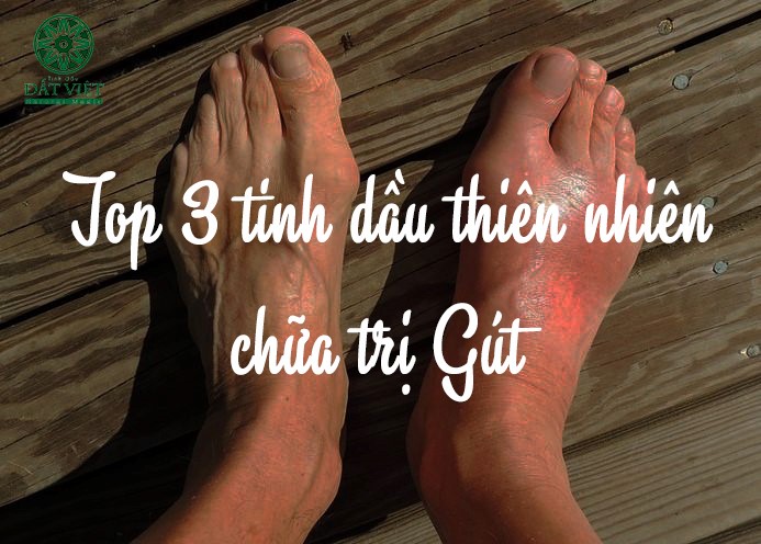 Tinh dầu thiên nhiên trị bệnh gout